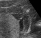 View - Ultrasound -  It's a boy! (second child)